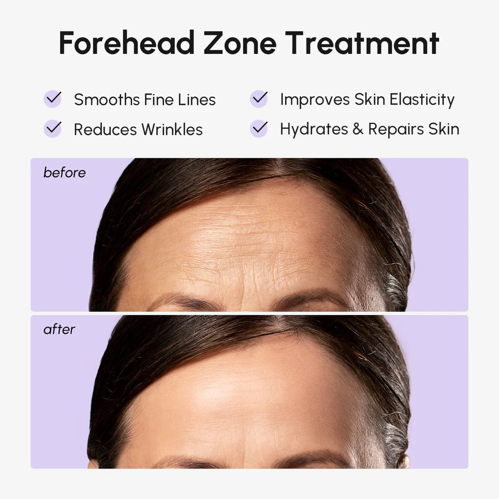 Collagen Forehead Wrinkle Patches Anti-Aging Treatment (30 patches)